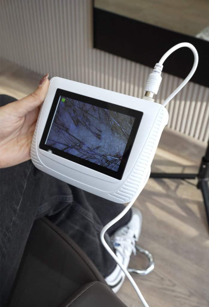 Scalp treatment before