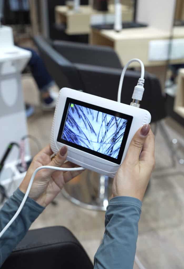 Scalp treatment results